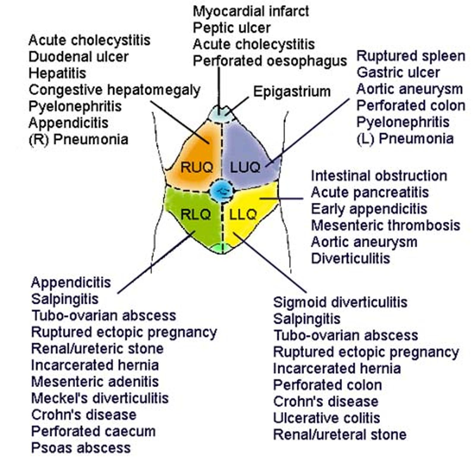 ACUTE ABDOMEN