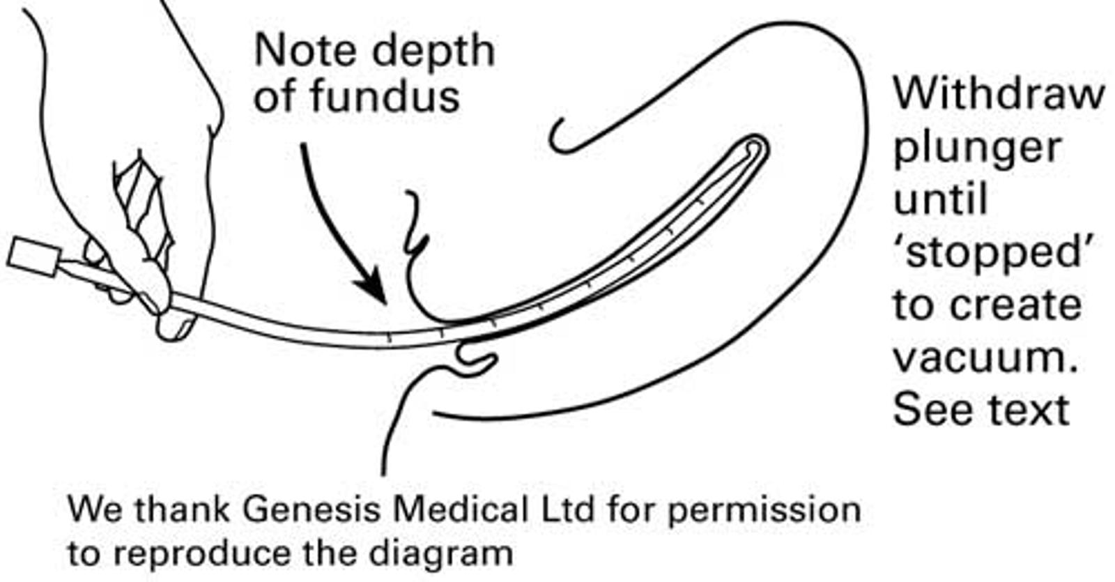 ENDOMETRIAL SAMPLING