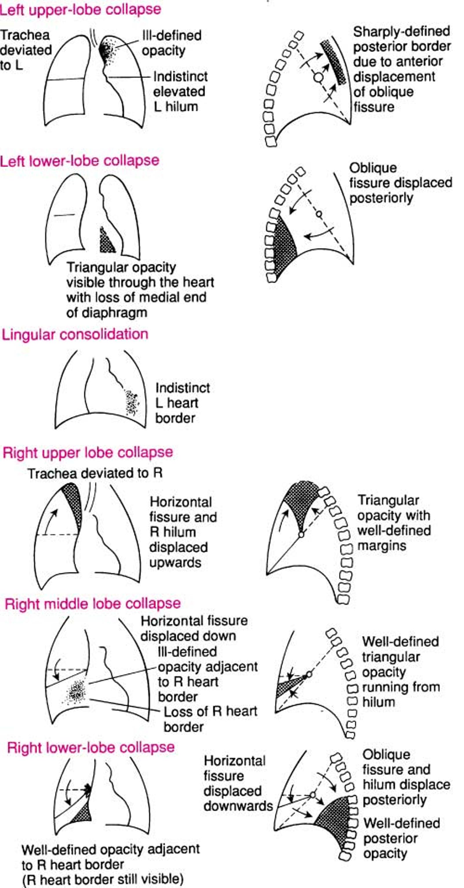 CHEST X-RAY - INTERPRETATION