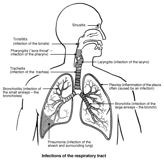 infections of the respiratory tract