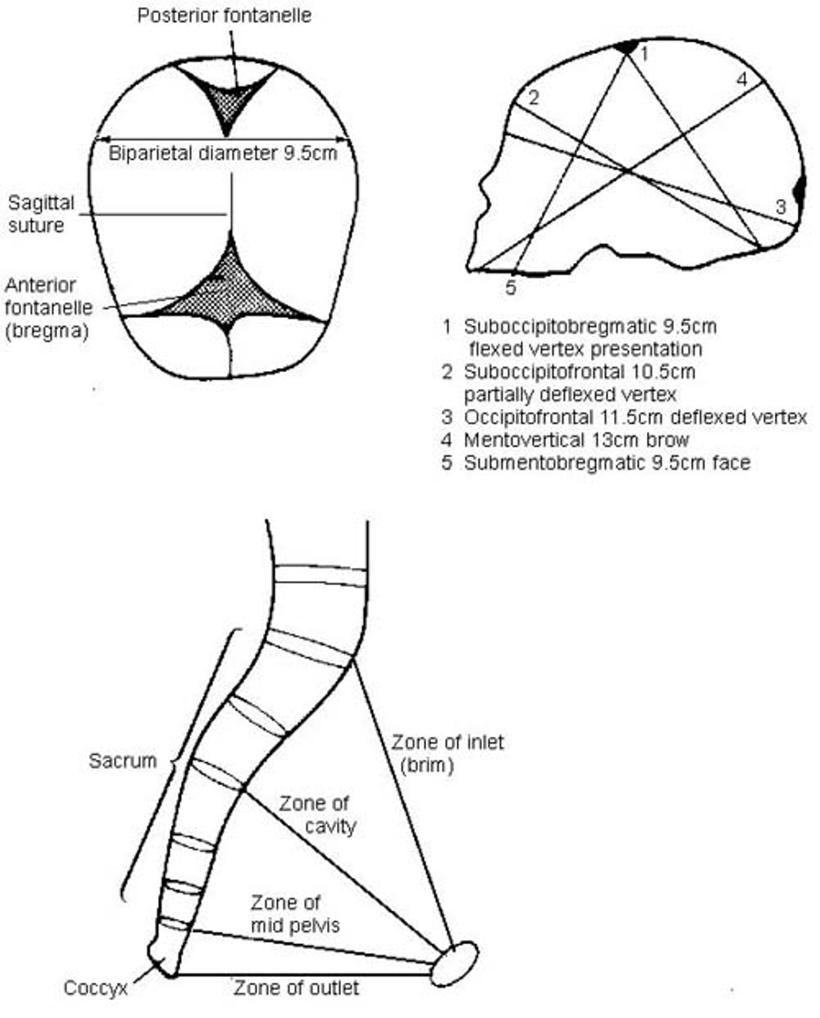 OBSTETRICS - THE PELVIS AND HEAD